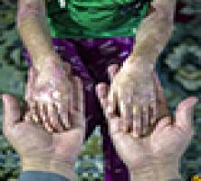 کودکانی که آهسته و بیصدا می‌میرند +تصاویر