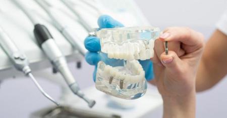 با مزایا و معایب ایمپلنت دندان بیشتر آشنا شوید