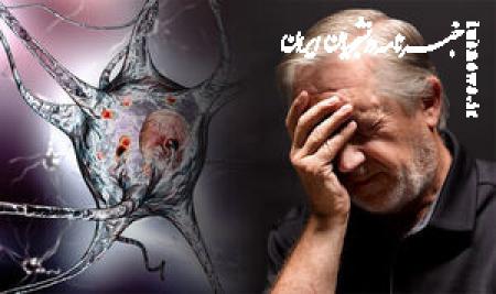 علائم اولیه آلزایمر