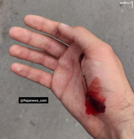 مجروح شدن حراست دانشگاه تهران با سلاح سرد