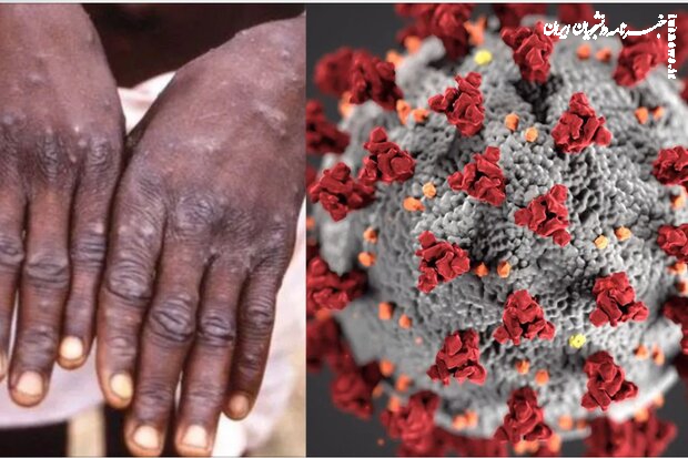 تغییر نام آبله میمون به MPox