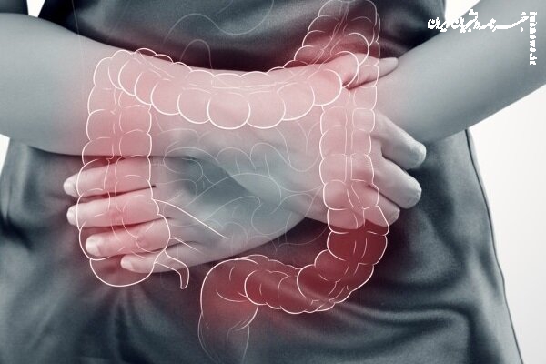 تاثیر رژیم غذایی کم پروتئین بر پیشرفت سرطان روده بزرگ