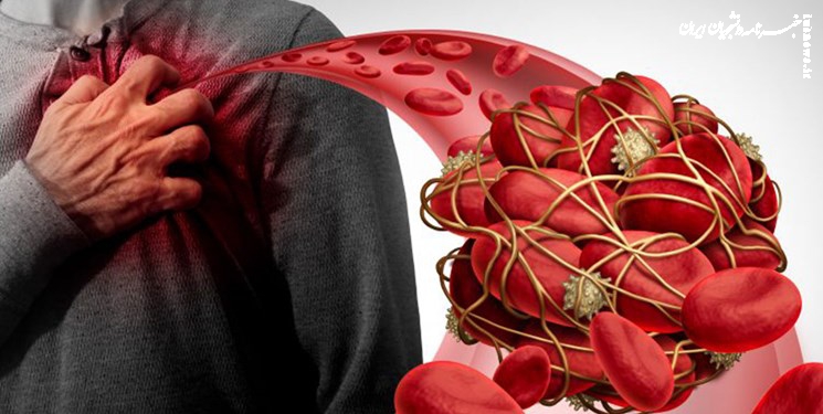 مقابله با ۵ نوع حمله قلبی با استفاده از هوش مصنوعی