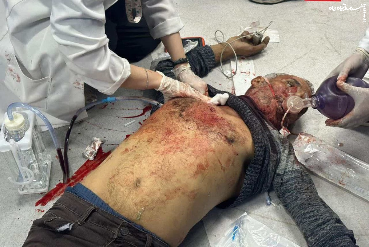 آخر حرامزادگی صهیونیست‌ها/ سگ هار در منطقه با بمباران بیمارستان غزه ۱۰۰۰ انسان بی‌گناه را به شهادت رساند