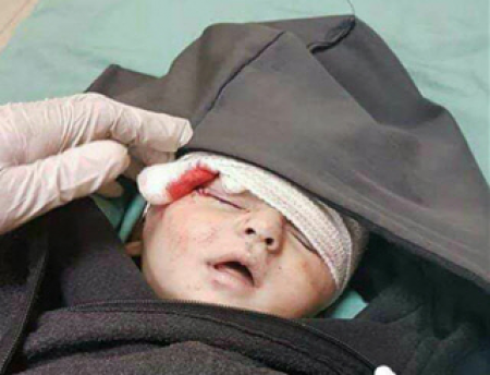 لحظه‌های نفس‌گیر برای نجات جان نوزاد در غزه +فیلم
