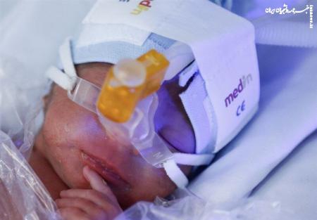 نخستین واکنش وزارت بهداشت به مرگ دلخراش کودک ۶ ماهه
