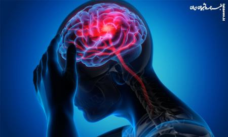 علائم ظاهری سکته مغزی چیست؟