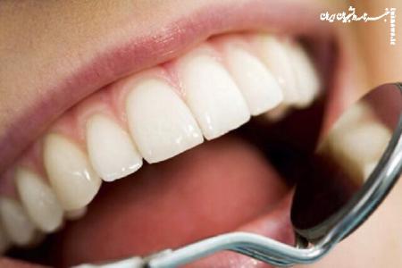  داروی رشد مجدد دندان‌ در فاز  آزمایش بالینی 