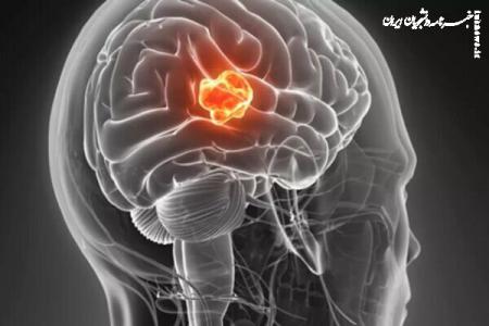 واکسن MRNA با تومور مرگبار مغز مبارزه می کند