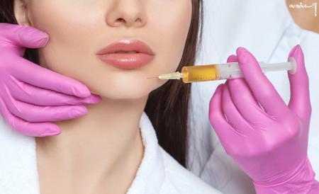 کارهایی که بلافاصله بعد از تزریق فیلر لب ممنوع است!