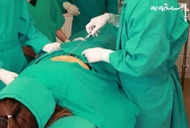 لیپوماتیک یا لیپوساکشن؟ کدام روش برای حذف چربی‌های اضافه مناسب‌تر است؟