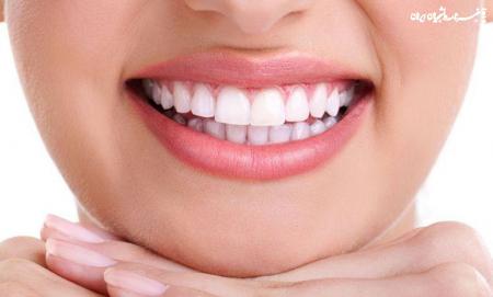 اصلاح طرح لبخند با کمک بهترین دندانپزشک زیبایی
