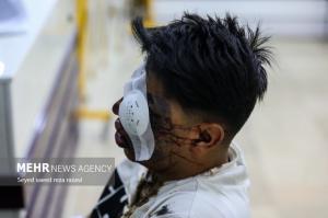 مصدومان شب چهارشنبه آخر سال ۱۴۰۳ +عکس