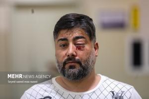 مصدومان شب چهارشنبه آخر سال ۱۴۰۳ +عکس