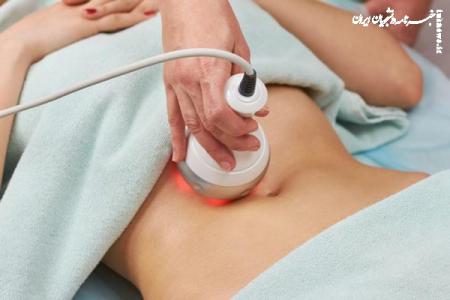 کویتیشن برای لاغری در نواحی مختلف بدن به چه صورت انجام می شود؟