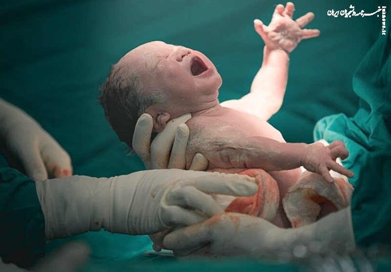 لزوم ترویج زایمان طبیعی بدون درد در کشور