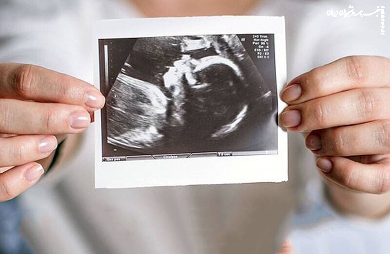 در بارداری چی خوبه بخوریم ؟ 