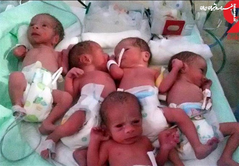 مستمری حمایتی بهزیستی برای خانواده‌های صاحب فرزند چندقلو