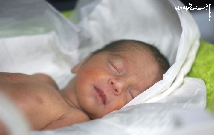 مصرف شیر مادر باعث افزایش زردی نوزاد می‌شود؟