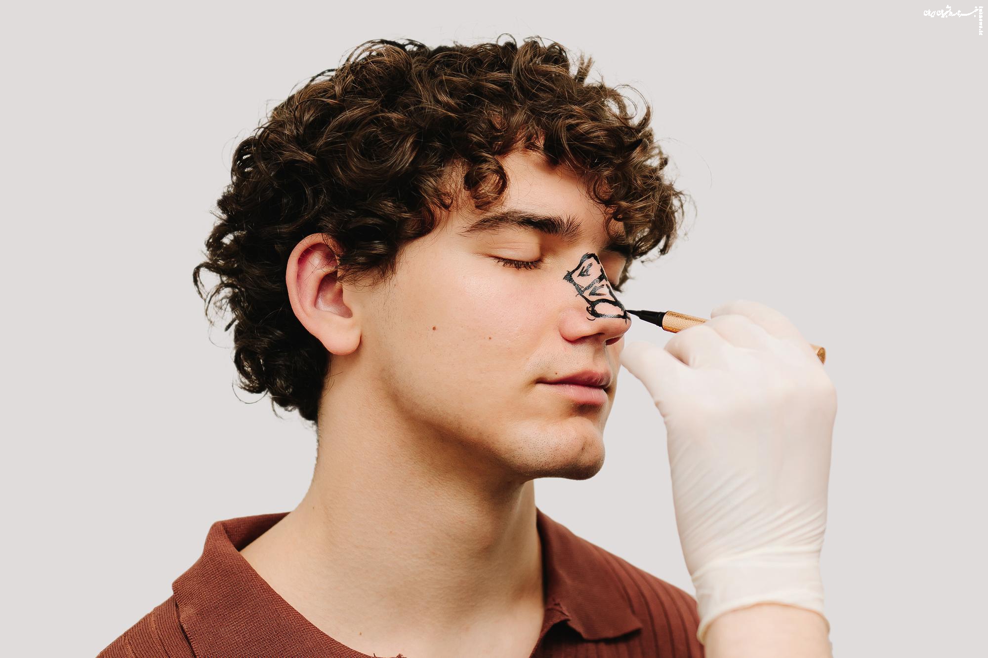 تفاوت بینی طبیعی عمل شده، سپتوپلاستی و آلارپلاستی