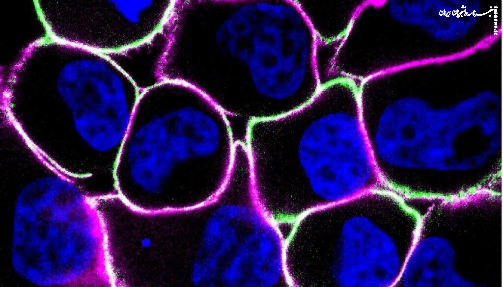 تشخیص سرطان با نور ممکن شد