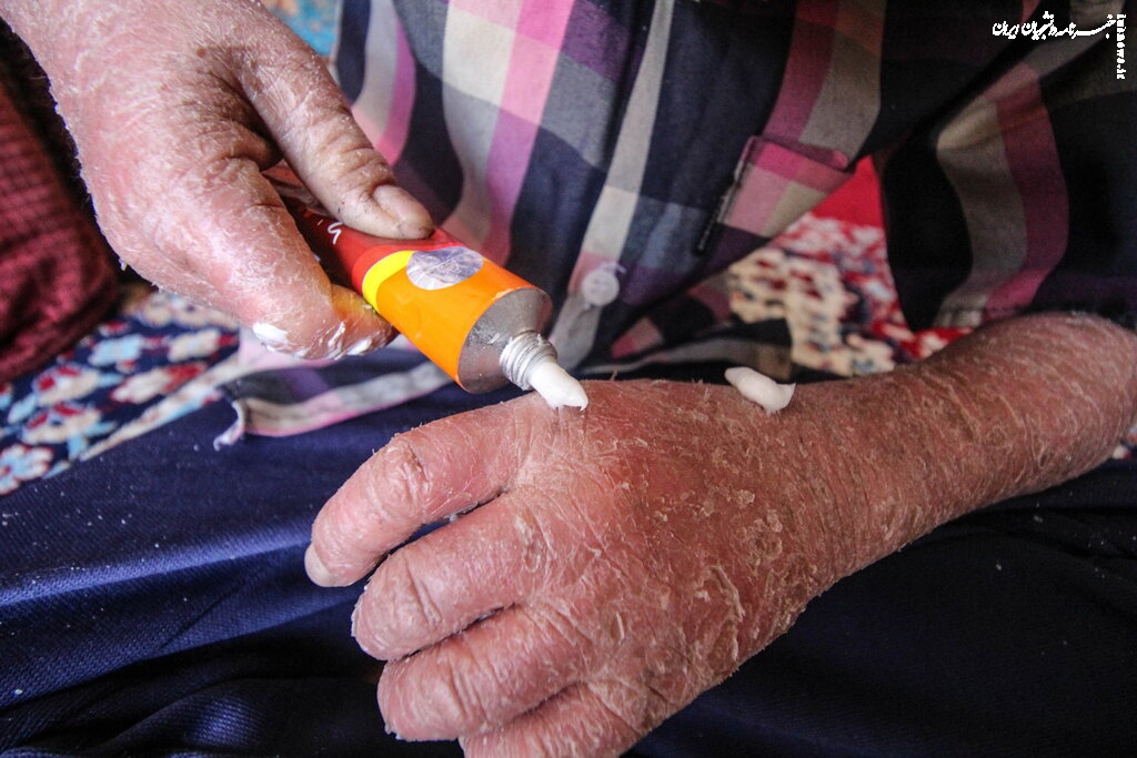 زخم بی‌توجهی بر تن پروانه‌ها