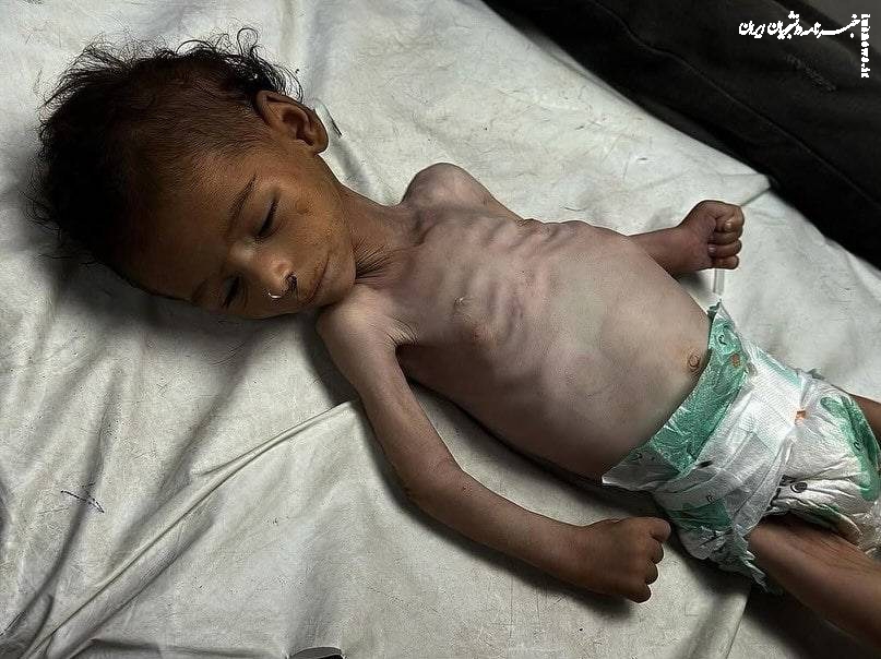 واکنش حماس به جنایت «زیکیم» و مرگ بیش از ۷۰ کودک بر اثر سوء تغذیه