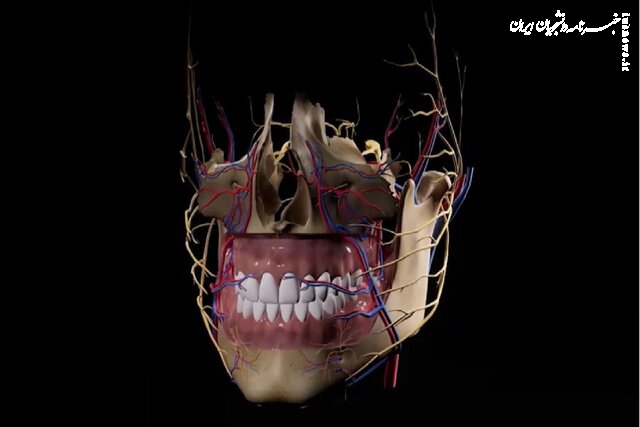  موفقیت جراحان کشور در عمل جمجمه بیمار تصادفی با ایمپلنت ایرانی جاذب استخوان