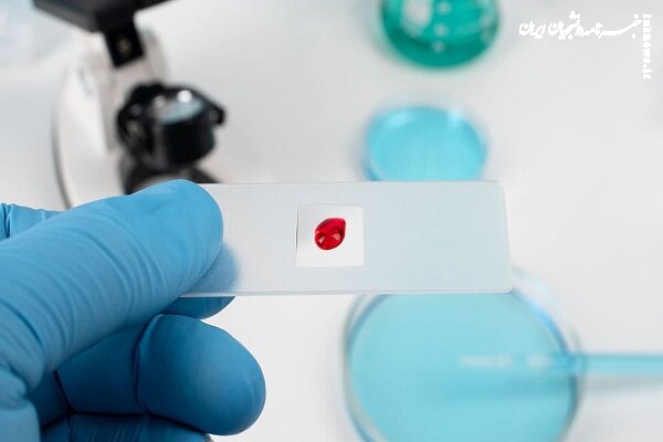 شیردهی از عوامل کاهش احتمال ابتلا به سرطان سینه 