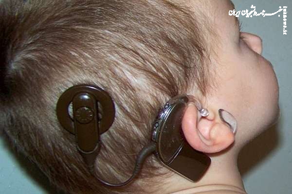 کاشت حلزون برای کودکان ناشنوا بهترین روش درمانی است