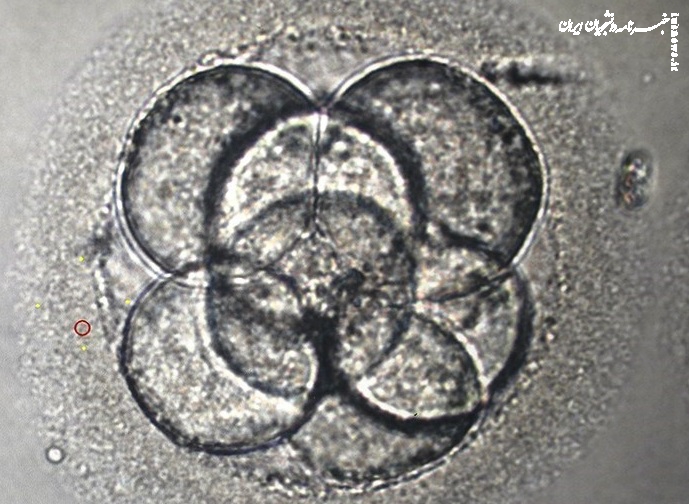 نوآوری در درمان ناباروری مردان با ویرایش ژنی