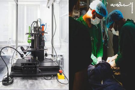  کوچک‌ترین چاپگر زیستی ۳ بُعدی جهان، ناجی تارهای صوتی می‌شود