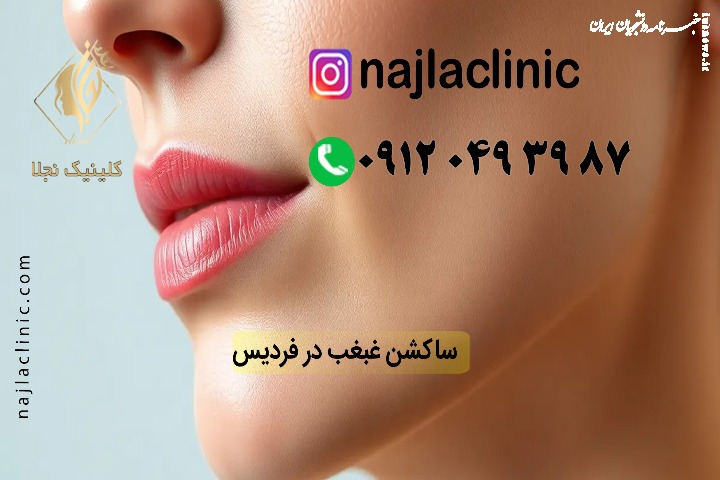 بهترین مرکز درمان و رفع غبغب در فردیس کرج
