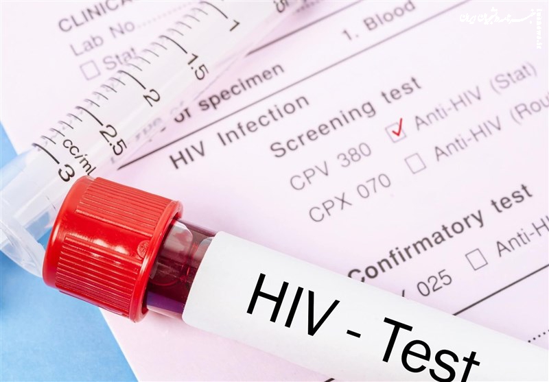 پویش «من هم تست HIV می‌دهم» آغاز شد