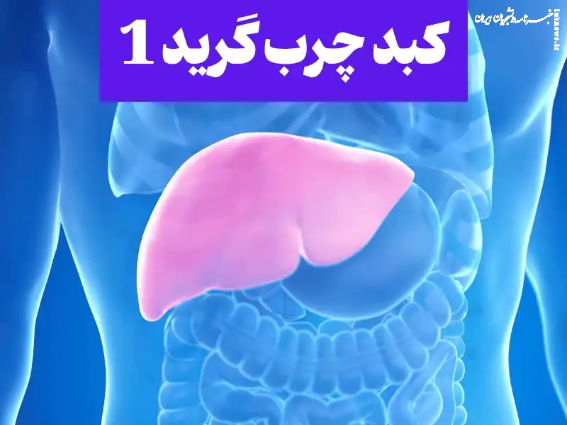 چرا کبد چرب گرید ۱(یک) خطرناک است؟ +برنامه غذایی