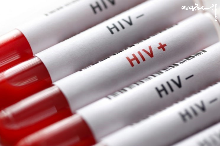 شناسایی ۲۵۰۰۰ مبتلا به HIV در ایران