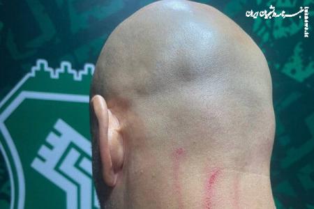 جراحت مربی دروازه‌بان‌های استقلال در پایان بازی با خیبر