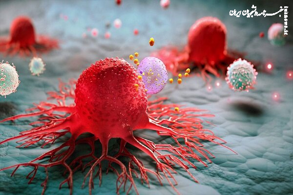 کاهش سن ابتلا به سرطان در ایران