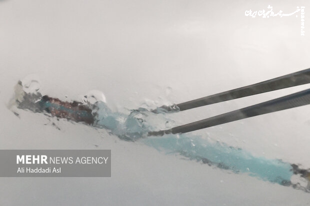 فریز جنین چیست و برای چه کسانی توصیه می‌شود؟