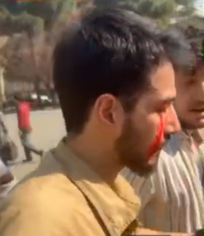 فیلم | خونریزی چشم یکی از دانشجویان، در ناآرامی‌های امروز دانشگاه تهران