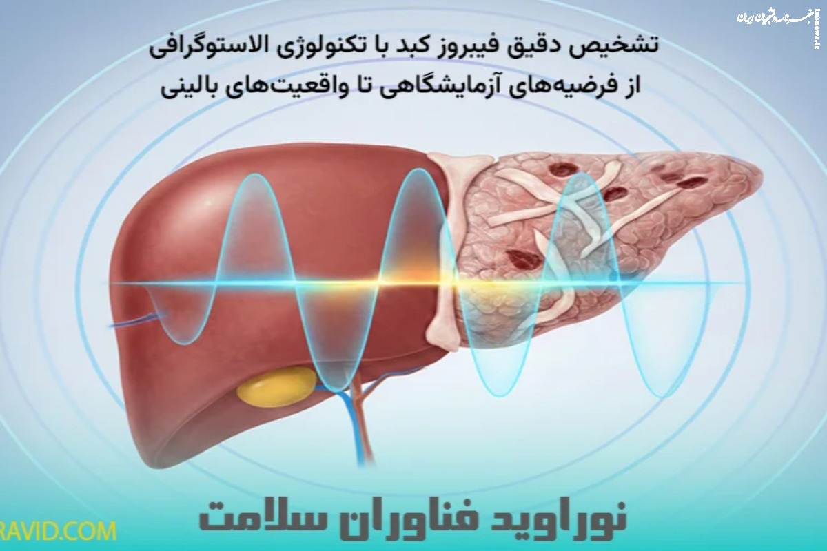 تشخیص دقیق فیبروز کبد با تکنولوژی الاستوگرافی؛ از فرضیه‌های آزمایشگاهی تا واقعیت‌های بالینی