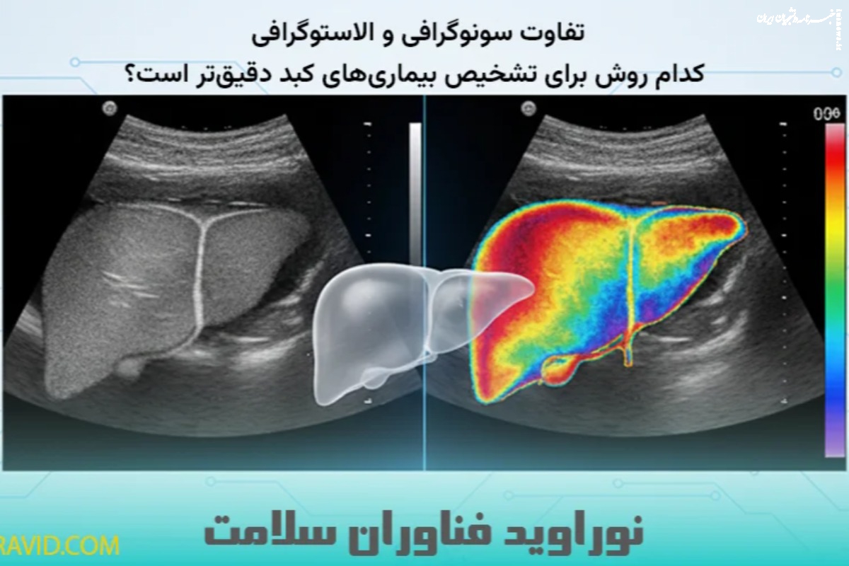 تفاوت سونوگرافی و الاستوگرافی؛ کدام روش برای تشخیص بیماری‌های کبد دقیق‌تر است؟