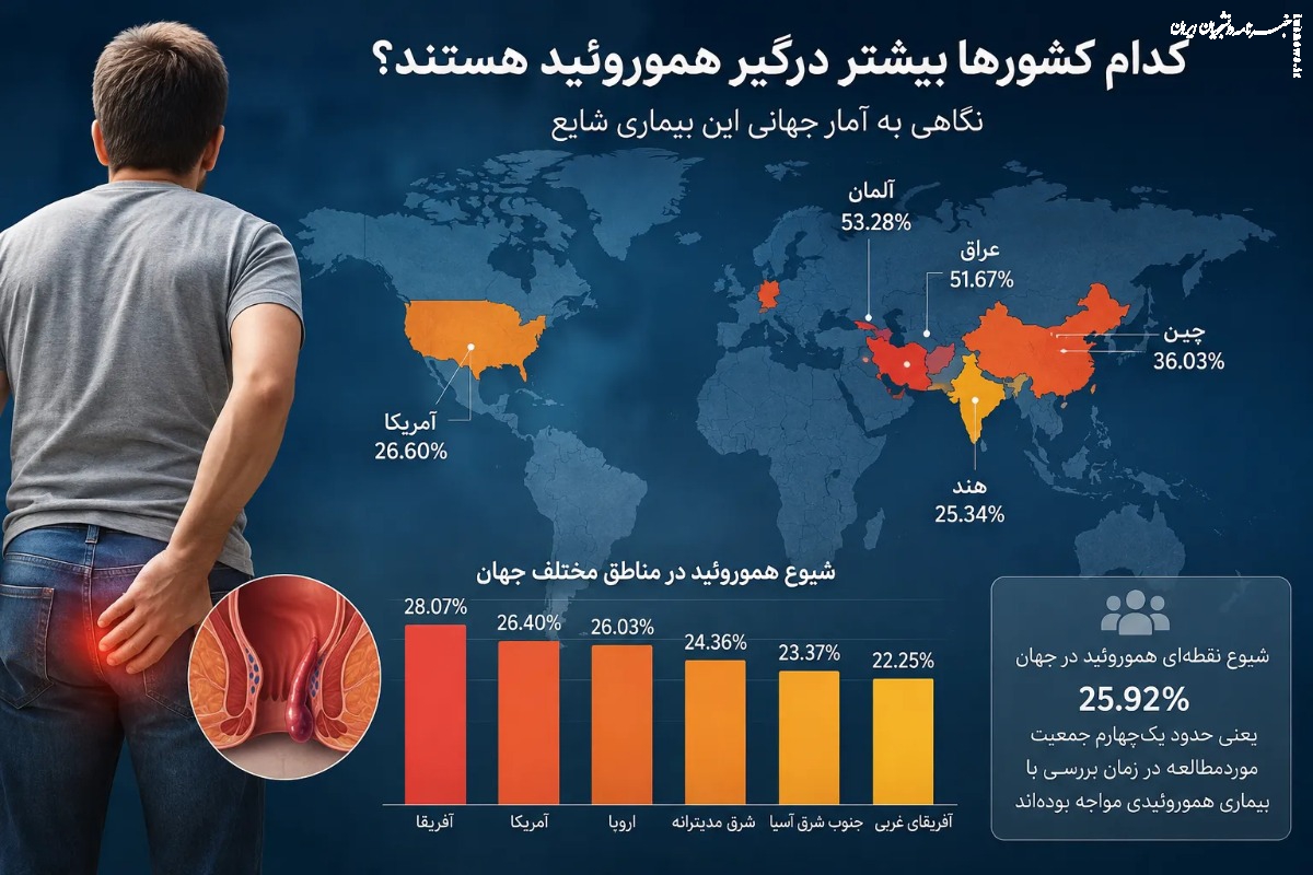 کدام کشورها بیشتر درگیر هموروئید هستند؟ نگاهی به آمار جهانی این بیماری