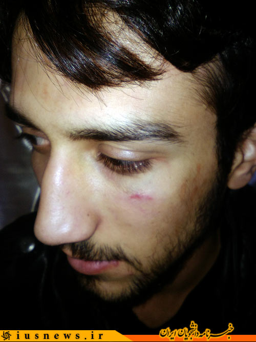 حمله مجدد به یکی دیگر از دانشجویان/ نصب متعدد پوستر سران فتنه در محل سخنرانی +فیلم و عکس