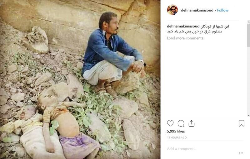 تصویری تکان‌دهنده در اینستاگرام «مسعود ده‌نمکی»