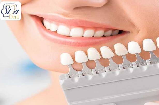 خدمات زیبایی دندان
