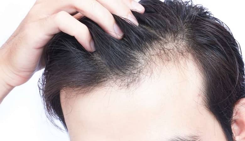 آیا بانک مو ترمیم می‌شود؟ 