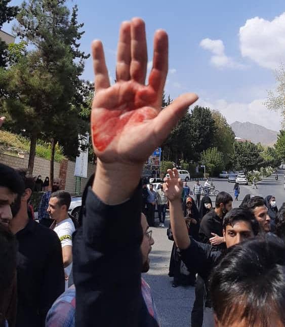ضرب و شتم دانشجویان بسیجی در دانشگاه شهید بهشتی +عکس