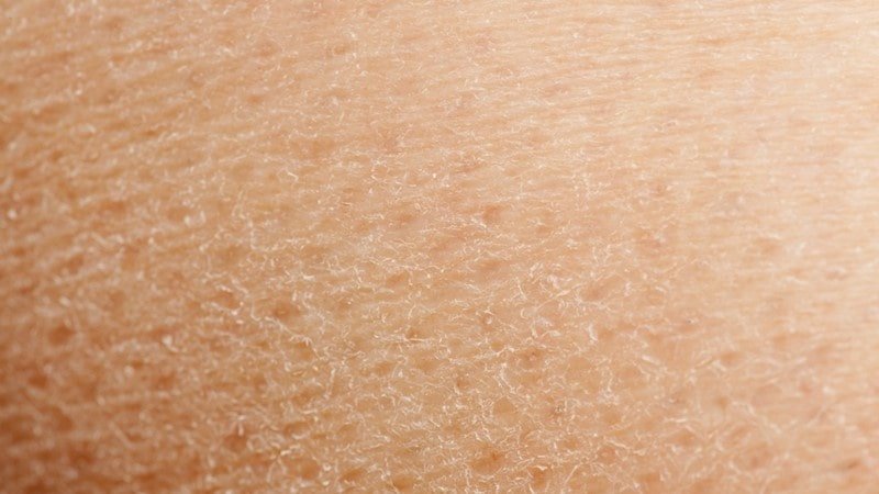 بهترین کرم مرطوب کننده قوی برای پوست خیلی خشک