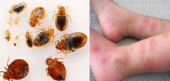 بیشتر شدن ساس در تهران و درمان قطعی ساس با سم ساس‌کش پیرانا